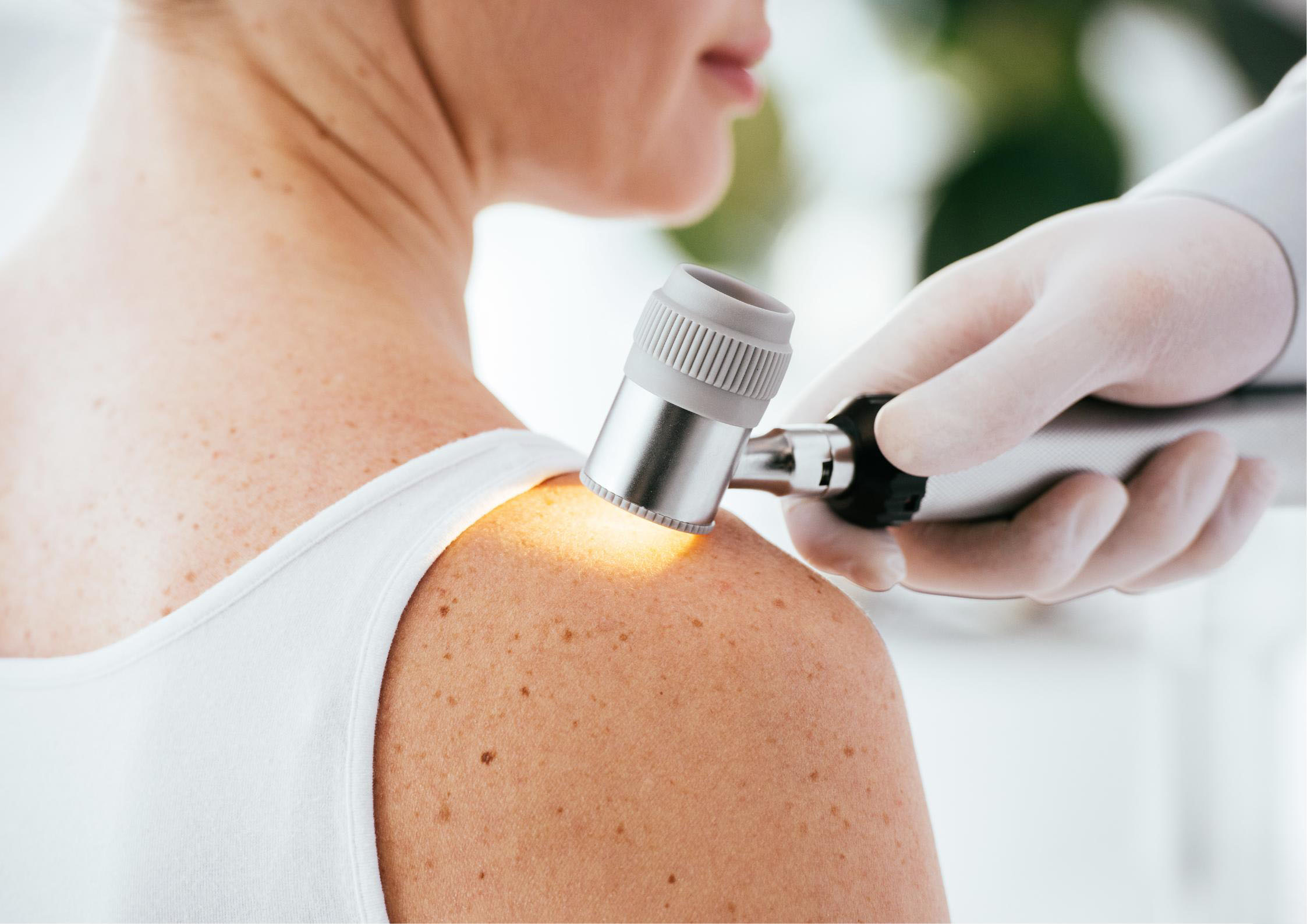 Dermatology treatment at Consultants Choice Clinic